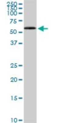 Western Blot: HDAC1 Antibody (3E1) [H00003065-M02] - HDAC1 monoclonal antibody (M02), clone 3E1. Analysis of HDAC1 expression in Raw 264.7.