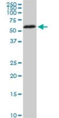 Western Blot: HDAC1 Antibody (3E1) [H00003065-M02] - HDAC1 monoclonal antibody (M02), clone 3E1. Analysis of HDAC1 expression in NIH/3T3.