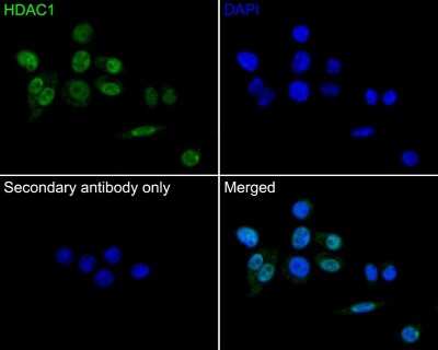 Immunocytochemistry/Immunofluorescence: HDAC1 Antibody (SY12-04) [NBP2-67389] - Analysis of SiHa cells labeling HDAC1 with Rabbit anti-HDAC1 antibody permeabilized with 0.05% Triton X-100 in PBS for 20 minutes, and then blocked with 2% negative goat serum for 30 minutes at room temperature. Cells were then incubated with Rabbit anti-HDAC1 antibody  was used as the secondary antibody at 1/1,000 dilution. PBS instead of the primary antibody was used as the secondary antibody only control. Nuclear DNA was labelled in blue with DAPI.