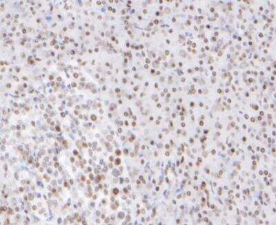 Immunohistochemistry-Paraffin: HDAC1 Antibody (SY12-04) [NBP2-67389] - Analysis of paraffin-embedded human pancreas tissue using anti-HDAC1 antibody. The section was pre-treated using heat mediated antigen retrieval with sodium citrate buffer (pH 6.0) for 20 minutes. The tissues were blocked in 5% BSA for 30 minutes at room temperature, washed with ddH2O and PBS, and then probed with the primary antibody (1/200) for 30 minutes at room temperature. The detection was performed using an HRP conjugated compact polymer system. DAB was used as the chromogen. Tissues were counterstained with hematoxylin and mounted with DPX.