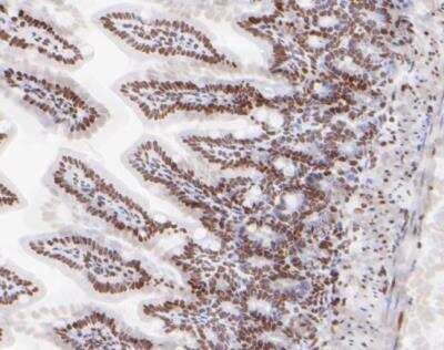 Immunohistochemistry-Paraffin: HDAC1 Antibody (SY12-04) [NBP2-67389] - Analysis of paraffin-embedded mouse colon tissue using anti-HDAC1 antibody. The section was pre-treated using heat mediated antigen retrieval with sodium citrate buffer (pH 6.0) for 20 minutes. The tissues were blocked in 5% BSA for 30 minutes at room temperature, washed with ddH2O and PBS, and then probed with the primary antibody (1/200) for 30 minutes at room temperature. The detection was performed using an HRP conjugated compact polymer system. DAB was used as the chromogen. Tissues were counterstained with hematoxylin and mounted with DPX.