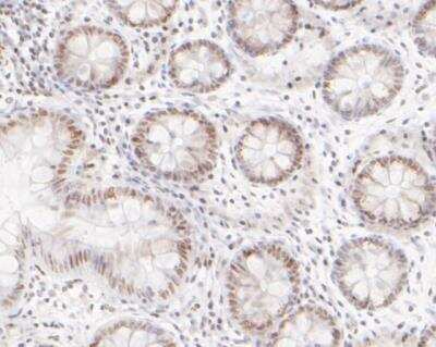 Immunohistochemistry-Paraffin: HDAC1 Antibody (SY12-04) [NBP2-67389] - Analysis of paraffin-embedded human colon tissue using anti-HDAC1 antibody. The section was pre-treated using heat mediated antigen retrieval with sodium citrate buffer (pH 6.0) for 20 minutes. The tissues were blocked in 5% BSA for 30 minutes at room temperature, washed with ddH2O and PBS, and then probed with the primary antibody (1/200) for 30 minutes at room temperature. The detection was performed using an HRP conjugated compact polymer system. DAB was used as the chromogen. Tissues were counterstained with hematoxylin and mounted with DPX.