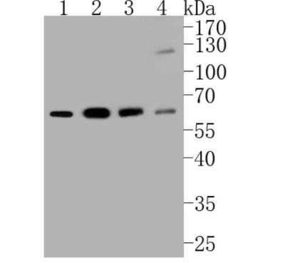 Western Blot: HDAC1 Antibody (SY12-04) [NBP2-67389] - Analysis of HDAC1 on different lysates. Proteins were transferred to a PVDF membrane and blocked with 5% BSA in PBS for 1 hour at room temperature. The primary antibody (1/500) was used in 5% BSA at room temperature for 2 hours. Goat Anti-Rabbit IgG - HRP Secondary Antibody at 1:5,000 dilution was used for 1 hour at room temperature. Positive control: Lane 2: MCF-7 cell lysateLane 2: Hela cell lysate Lane 2: Jurkat cell lysate Lane 2: K562 cell lysate