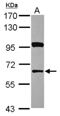 Western Blot: HDAC1 Antibody [NBP2-16788] - Sample (30 ug of whole cell lysate) A: Jurkat 7. 5% SDS PAGE gel, diluted at 1:1000.