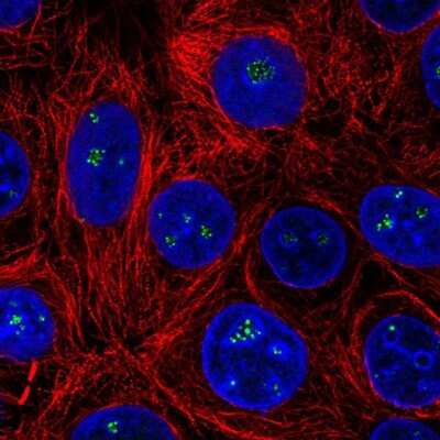 Immunocytochemistry/Immunofluorescence: HDAC10 Antibody [NBP2-56663] - Staining of human cell line MCF7 shows localization to nucleoli fibrillar center.