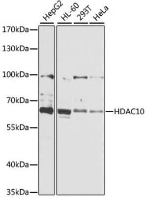 Western Blot: HDAC10 Antibody [NBP3-04562] - Analysis of extracts of various cell lines, using HDAC10 antibody at 1:1000 dilution. Secondary antibody: HRP Goat Anti-Rabbit IgG (H+L) at 1:10000 dilution. Lysates/proteins: 25ug per lane. Blocking buffer: 3% nonfat dry milk in TBST. Detection: ECL Basic Kit