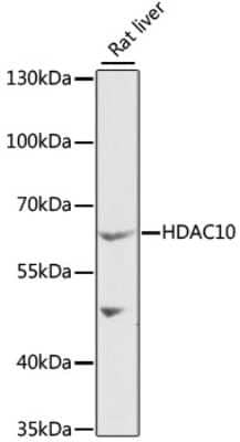 Western Blot: HDAC10 Antibody [NBP3-04562] - Analysis of extracts of rat liver, using HDAC10 antibody at 1:1000 dilution. Secondary antibody: HRP Goat Anti-Rabbit IgG (H+L) at 1:10000 dilution. Lysates/proteins: 25ug per lane. Blocking buffer: 3% nonfat dry milk in TBST. Detection: ECL Basic Kit .