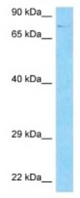 Western Blot: HDAC10 Antibody [NBP3-09973] - Western blot analysis of HDAC10 in ACHN Whole Cell lysates. Antibody dilution at 1.0ug/ml