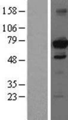 Western Blot HDAC10 Overexpression Lysate