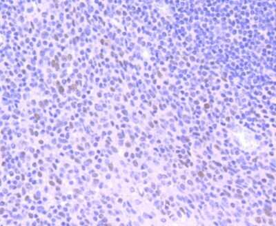 Immunohistochemistry-Paraffin: HDAC3 Antibody (SC55-02) [NBP2-67592] - Analysis of paraffin-embedded human tonsil tissue using anti-HDAC3 antibody. Counter stained with hematoxylin.