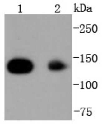 Western Blot: HDAC4+5+9 Antibody (SD08-35) [NBP2-67782] - Analysis of HDAC4 on different lysates using anti-HDAC4 antibody at 1/1,000 dilution. Positive control: Lane 1: Hela Lane 2: HepG2