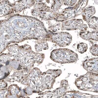 Immunohistochemistry-Paraffin: HDAC5 Antibody (CL8121) [NBP2-88913] - Staining of human placenta shows moderate to strong nuclear positivity in trophoblastic cells.