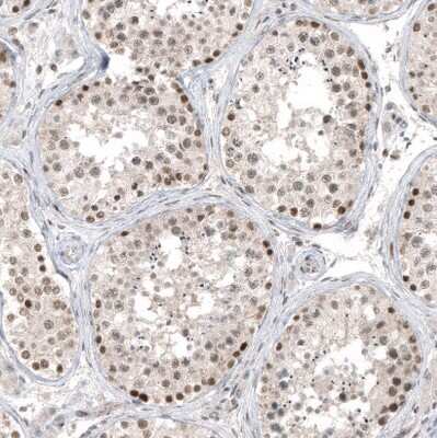 Immunohistochemistry-Paraffin: HDAC5 Antibody (CL8121) [NBP2-88913] - Staining of human testis shows moderate to strong nuclear positivity in cells in seminiferous ducts.