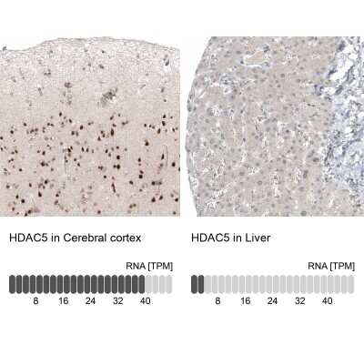 Immunohistochemistry-Paraffin: HDAC5 Antibody (CL8121) [NBP2-88913] - Analysis in human cerebral cortex and liver tissues using NBP2-88913 antibody. Corresponding HDAC5 RNA-seq data are presented for the same tissues.