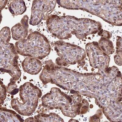 Immunohistochemistry-Paraffin: HDAC5 Antibody [NBP1-83436] - Staining of human placenta shows moderate cytoplasmic positivity and strong nuclear positivity in trophoblastic cells.