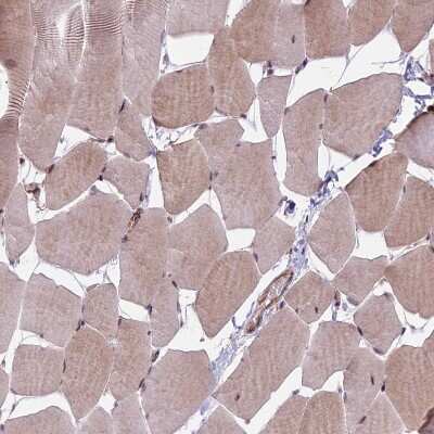 Immunohistochemistry-Paraffin: HDAC5 Antibody [NBP1-83436] - Staining of human skeletal muscle shows weak cytoplasmic and nuclear positivity in myocytes.