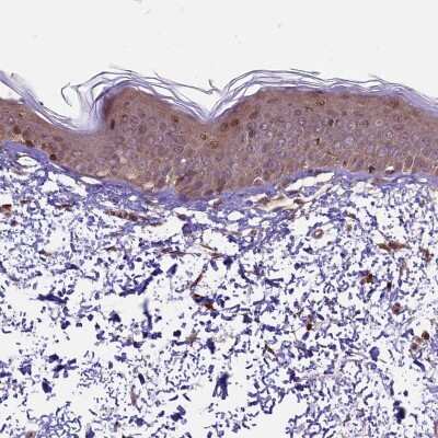 Immunohistochemistry-Paraffin: HDAC5 Antibody [NBP1-83436] - Staining of human skin shows moderate cytoplasmic positivity and strong nuclear positivity in squamous epithelial cells.