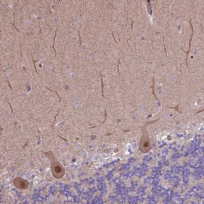 Immunohistochemistry-Paraffin: HDAC5 Antibody [NBP1-83436] - Staining of human cerebellum shows weak cytoplasmic positivity and moderate nuclear positivity in Purkinje cells.