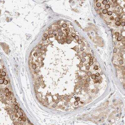 Immunohistochemistry-Paraffin: HDAC6 Antibody [NBP1-82212] - Staining of human testis shows strong cytoplasmic positivity in cells in seminiferous ducts and Leydig cells.