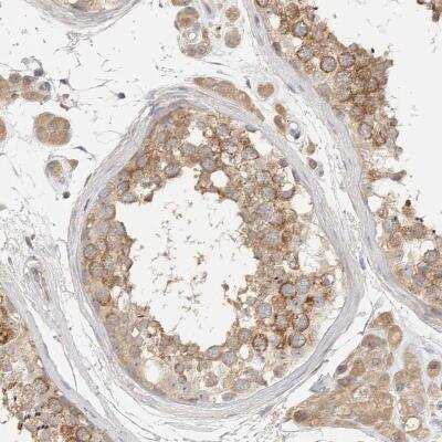 Immunohistochemistry-Paraffin: HDAC6 Antibody [NBP1-82213] - Staining of human testis shows cytoplasmic positivity in cells in seminiferous ducts and Leydig cells.