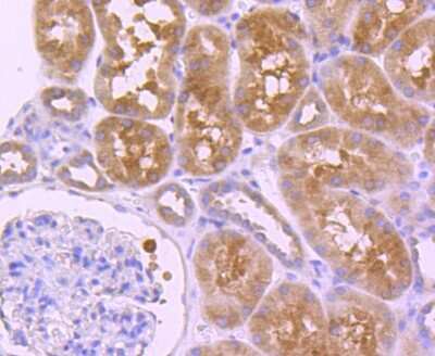 Immunohistochemistry-Paraffin: HDAC6 Antibody (JJ09-09) [NBP2-67891] - Analysis of paraffin-embedded human kidney tissue using anti-HDAC6 antibody. Counter stained with hematoxylin.