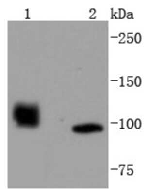 Western Blot: HDAC7 Antibody (SD082-4) [NBP2-67799] - Analysis of HDAC7 on different lysates using anti-HDAC7 antibody at 1/1,000 dilution. Positive control: Lane 1: A549 Lane 2: Human brain