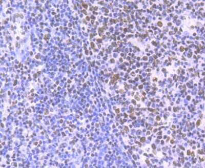 Immunohistochemistry-Paraffin: HDAC9 Antibody (JU30-44) [NBP2-75519] - Analysis of paraffin-embedded human tonsil tissue using anti-HDAC9 antibody. Counter stained with hematoxylin.