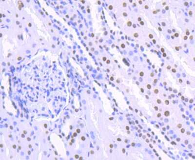 Immunohistochemistry-Paraffin: HDAC9 Antibody (JU30-44) [NBP2-75519] - Analysis of paraffin-embedded human kidney tissue using anti-HDAC9 antibody. Counter stained with hematoxylin.