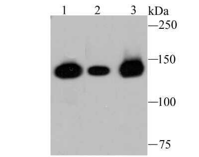 Western Blot: HDAC9 Antibody (JU30-44) [NBP2-75519] - Analysis of HDAC9 on different lysates using anti-HDAC9 antibody at 1/1,000 dilution.Positive control:Lane 1: K562   Lane 2: HepG2  Lane 3: Raji