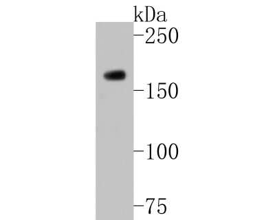 Western Blot: HDAC9 Antibody (JU30-44) [NBP2-75519] - Western blot analysis of HDAC9 on K562 cell lysates. Proteins were transferred to a PVDF membrane and blocked with 5% BSA in PBS for 1 hour at room temperature. The primary antibody (1/500) was used in 5% BSA at room temperature for 2 hours. Goat Anti-Rabbit IgG - HRP Secondary Antibody (HA1001) at 1:5,000 dilution was used for 1 hour at room temperature.