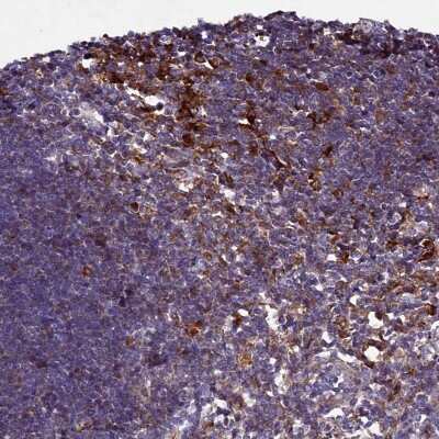 Immunohistochemistry-Paraffin: HDC Antibody [NBP1-90985] - Staining of human lymph node shows positivity in lymphoid cells.