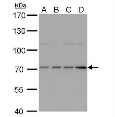 Western Blot: HDC Antibody [NBP2-16797] - A. 30 ug Jurkat whole cell lysate/extract B. 30 ug Raji whole cell lysate/extract C. 30 ug K562 whole cell lysate/extract D. 30 ug NCI-H929 whole cell lysate/extract 7.5 % SDS-PAGE HDC antibody [N3C2], Internal  dilution: 1:1000