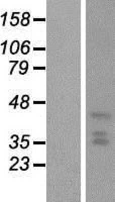 Western Blot: HDC2/PHC2 Overexpression Lysate (Adult Normal) [NBP2-10592] Left-Empty vector transfected control cell lysate (HEK293 cell lysate); Right -Over-expression Lysate for HDC2/PHC2.
