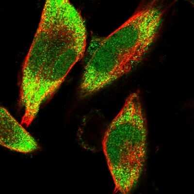 Immunocytochemistry/Immunofluorescence: HDDC3 Antibody [NBP1-82684] - Immunofluorescent staining of human cell line U-251 MG shows localization to nucleoplasm & cytosol.