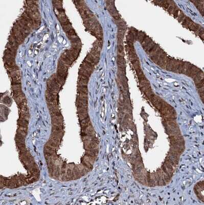 Immunohistochemistry-Paraffin: HDDC3 Antibody [NBP1-82684] - Staining of human Fallopian tube shows strong cytoplasmic positivity in glandular cells.