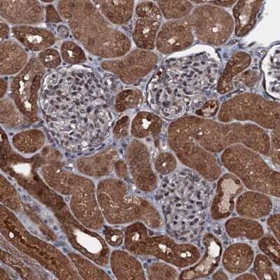 Immunohistochemistry-Paraffin: HDDC3 Antibody [NBP1-82684] - Staining of human kidney shows strong cytoplasmic positivity in cells in tubules.