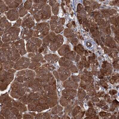 Immunohistochemistry-Paraffin: HDDC3 Antibody [NBP1-82684] - Staining of human pancreas shows strong cytoplasmic positivity in exocrine glandular cells.