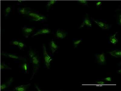 Immunocytochemistry/Immunofluorescence: HDGF Antibody (2D6) [H00003068-M09] - Analysis of monoclonal antibody to HDGF on HeLa cell. Antibody concentration 10 ug/ml