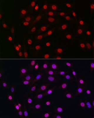 Immunocytochemistry/Immunofluorescence: HDGF Antibody (5U7A7) [NBP3-15281] - Immunofluorescence analysis of NIH/3T3 cells using HDGF Rabbit mAb (NBP3-15281) at dilution of 1:100 (40x lens). Blue: DAPI for nuclear staining.