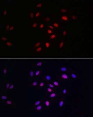 Immunocytochemistry/Immunofluorescence: HDGF Antibody (5U7A7) [NBP3-15281] - Immunofluorescence analysis of U2OS cells using HDGF Rabbit mAb (NBP3-15281) at dilution of 1:100 (40x lens). Blue: DAPI for nuclear staining.