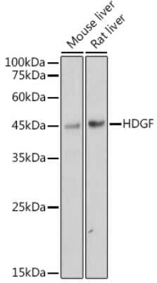 Western Blot: HDGF Antibody (5U7A7) [NBP3-15281] - Western blot analysis of extracts of various cell lines, using HDGF antibody (NBP3-15281) at 1:1000 dilution. Secondary antibody: HRP Goat Anti-Rabbit IgG (H+L) at 1:10000 dilution. Lysates/proteins: 25ug per lane. Blocking buffer: 3% nonfat dry milk in TBST. Detection: ECL Basic Kit. Exposure time: 1s.