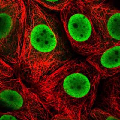 Immunocytochemistry/ Immunofluorescence HDGF Antibody - BSA Free