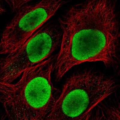 Immunocytochemistry/Immunofluorescence: HDGF Antibody [NBP2-38701] - Immunofluorescent staining of human cell line U-2 OS shows localization to nucleoplasm.