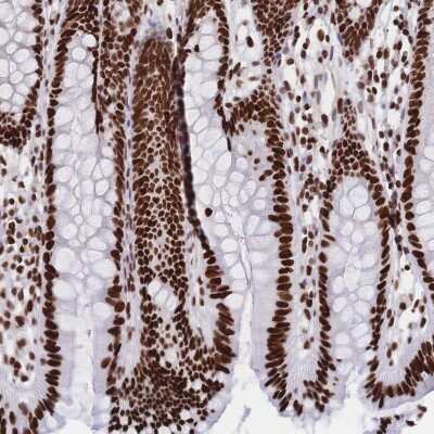 Immunohistochemistry: HDGF Antibody [NBP2-38589] - Staining of human colon shows strong nuclear positivity in glandular cells.