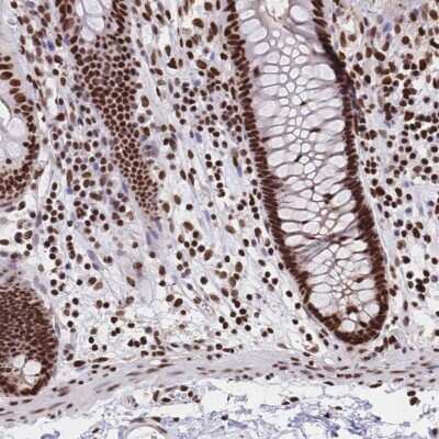 Immunohistochemistry: HDGF Antibody [NBP2-38701] - Staining of human colon shows nuclear positivity.