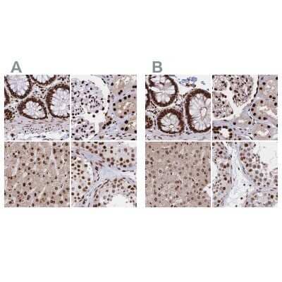 <b>Independent Antibodies Validation. </b>Immunohistochemistry-Paraffin: HDGF Antibody [NBP2-38589] - Staining of human colon, kidney, liver and testis using Anti-HDGF antibody NBP2-38589 (A) shows similar protein distribution across tissues to independent antibody NBP2-38701 (B).