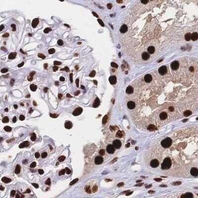 Immunohistochemistry-Paraffin: HDGF Antibody [NBP2-38589] - Staining of human kidney.