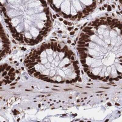 Immunohistochemistry-Paraffin: HDGF Antibody [NBP2-38589] - Staining of human colon.