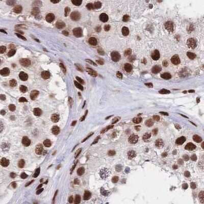 Immunohistochemistry-Paraffin: HDGF Antibody [NBP2-38589] - Staining of human testis.