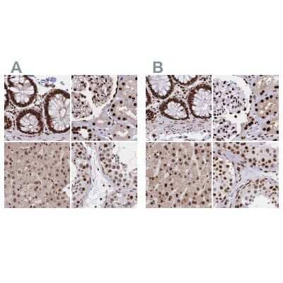 <b>Independent Antibodies Validation. </b>Immunohistochemistry-Paraffin: HDGF Antibody [NBP2-38701] - Staining of human colon, kidney, liver and testis using Anti-HDGF antibody NBP2-38701 (A) shows similar protein distribution across tissues to independent antibody NBP2-38589 (B).